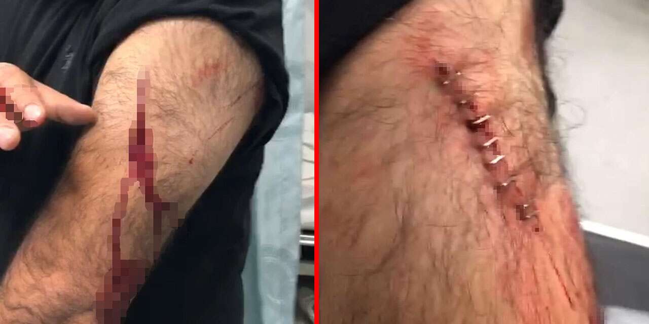 Öğretmene sokak ortasında jiletli saldırı