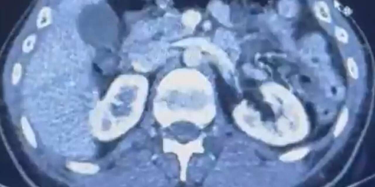 Her şey hastane muayenesinde ortaya çıktı! 3 kişi gözaltına alındı