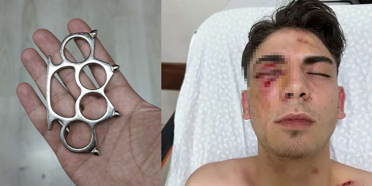 Konya’da kör eden muştalı saldırıda yeni gelişme! Tekrar gözaltına alındılar