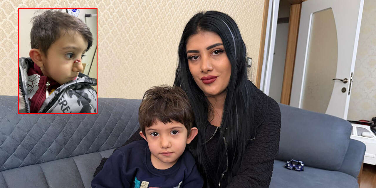 Konya’da 4 yaşındaki çocuk kreşte bu hale geldi