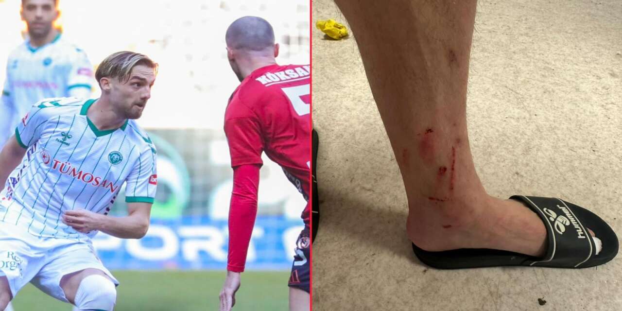 Konyasporlu Berkan Kutlu’nun yaralandığı pozisyon olay oldu