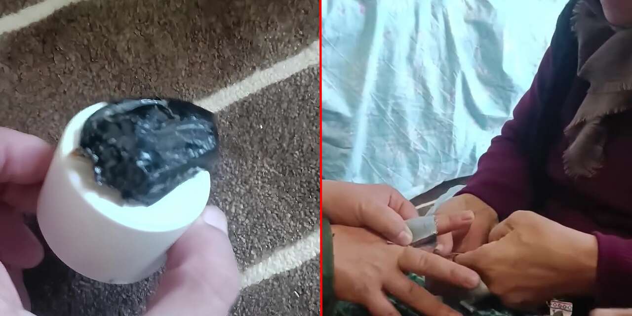 Konya’da geleneksel tıbbın ilacı: Kara hekim