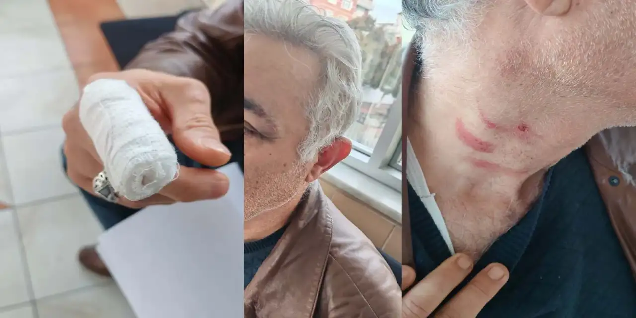 Konya’da Doktor Ahmet Tolu’ya saldırı iddiası