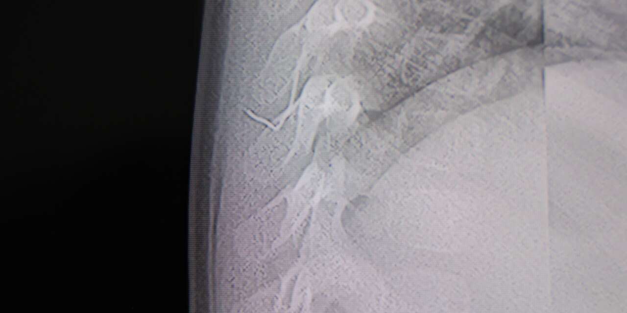 Sırt üstü yatınca ağlayan bebeğin içinden çıkan korkuttu