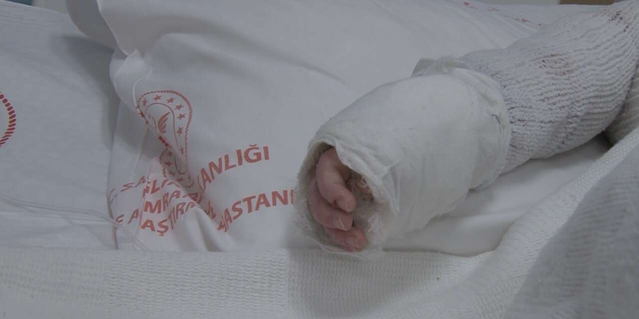 Üzerine kaynar su dökülen bebek hastaneye kaldırıldı