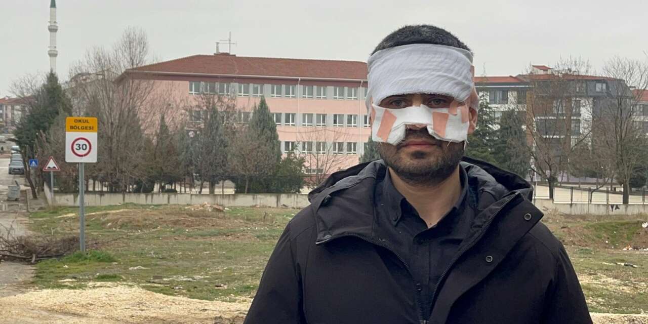 Lisede şok iddia! Rehber öğretmen, fizikçinin yüzünü kaynar çayla yaktı