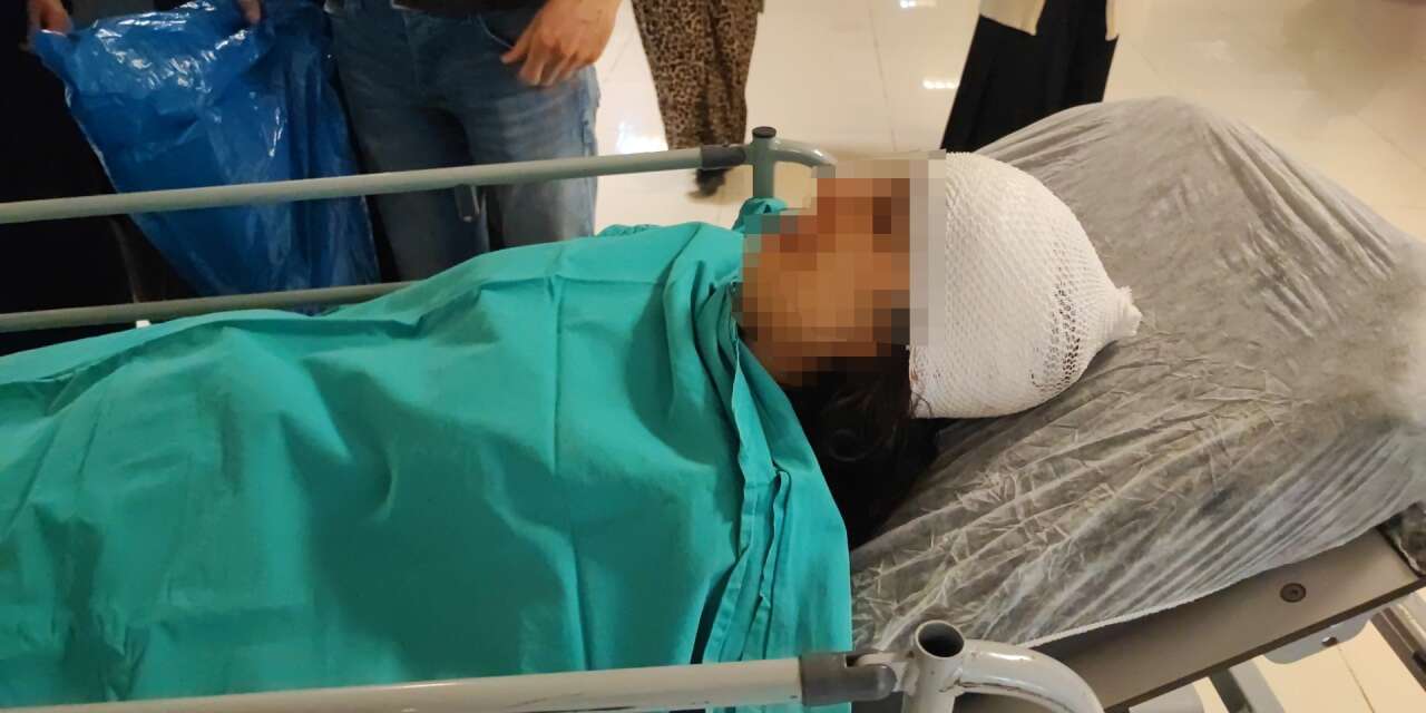 Ekmek almaya giderken sokak köpekleri saldırdı