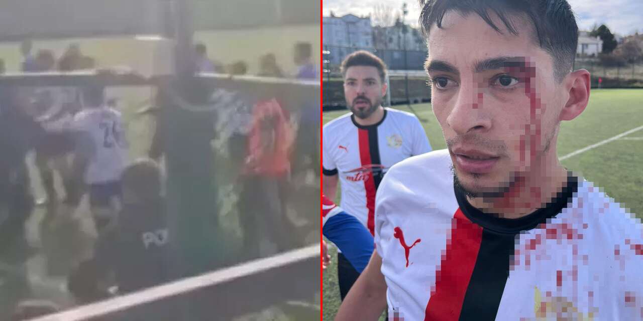 Maçın bitiş düdüğüyle saha karıştı, 3 futbolcu yaralandı