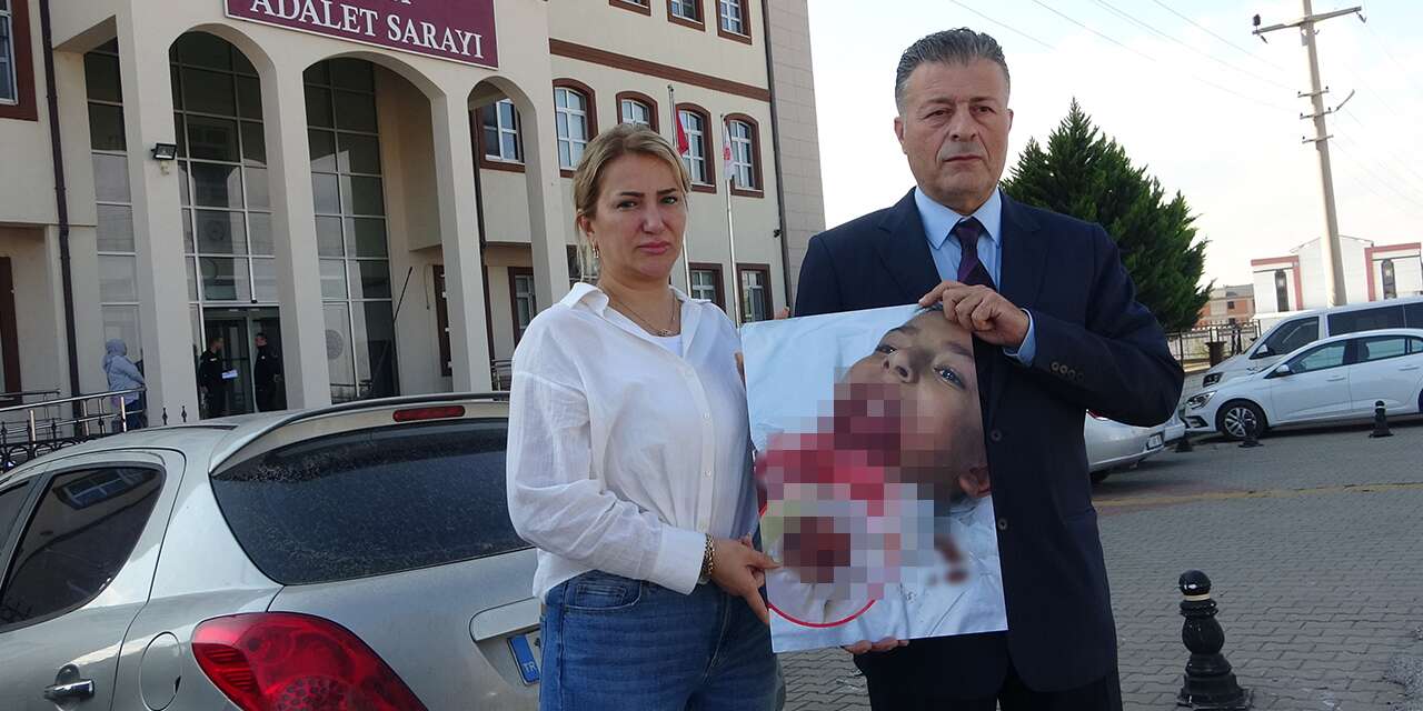 Okulda başına gelmeyen kalmadı! Çenesine demir saplandı, dudağı koptu