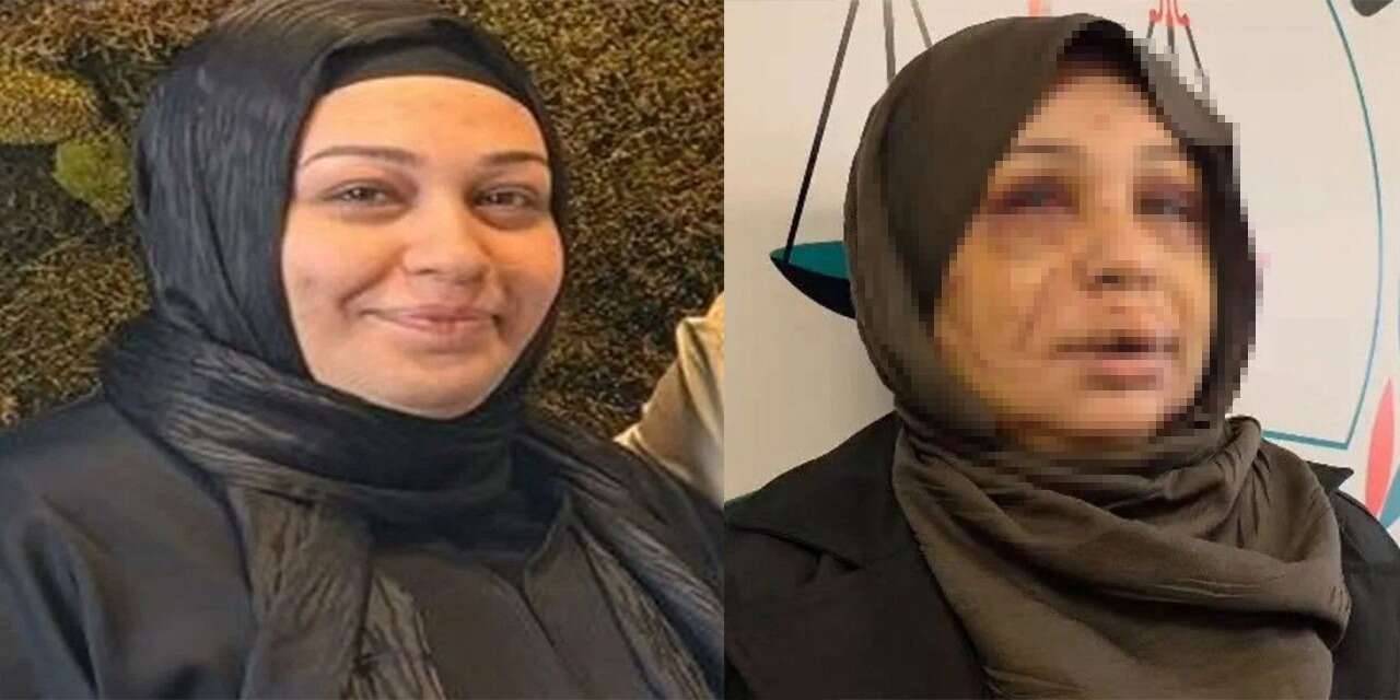 Polis memuru, eşinin yüzünü jiletle parçaladı! İddialar vahim