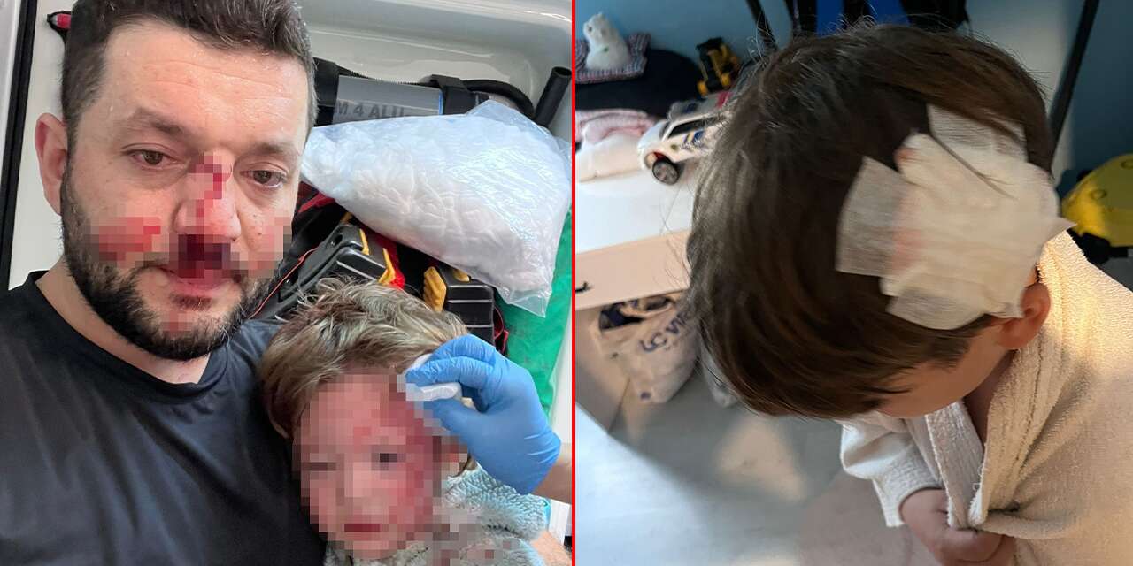 Komşu kavgasında kızının ardından oğlu da saldırıya uğradı