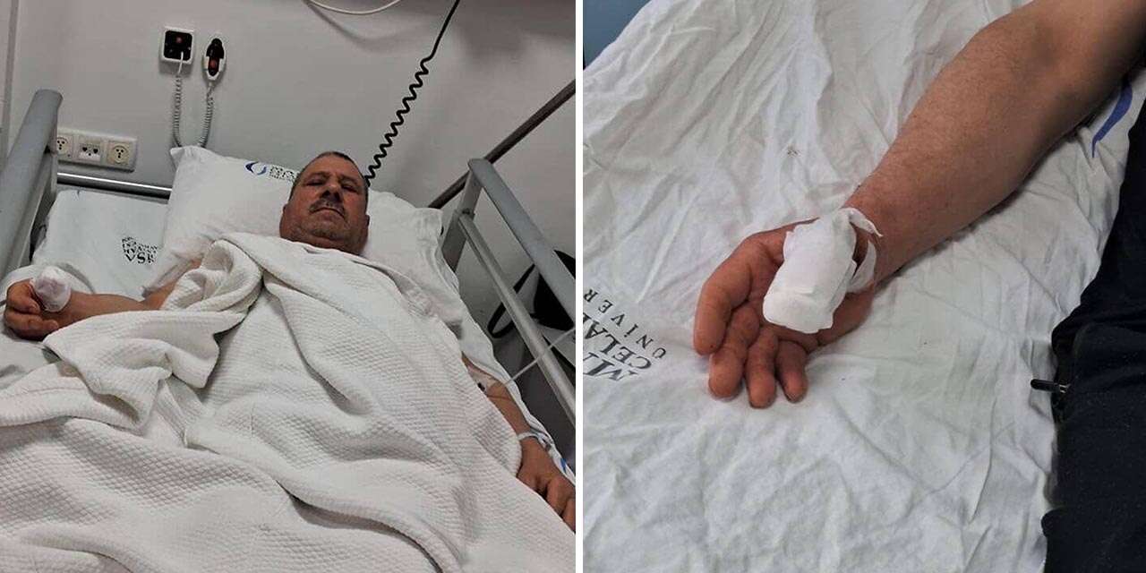 Sokak köpeklerinin saldırdığı adamın parmağı koptu