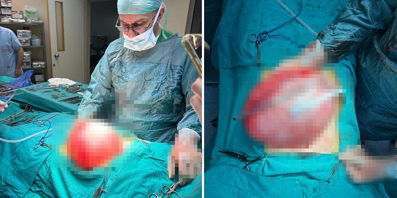 14 yaşındaki kız kilo aldığı sandı! Gerçek ultrasonda ortaya çıktı