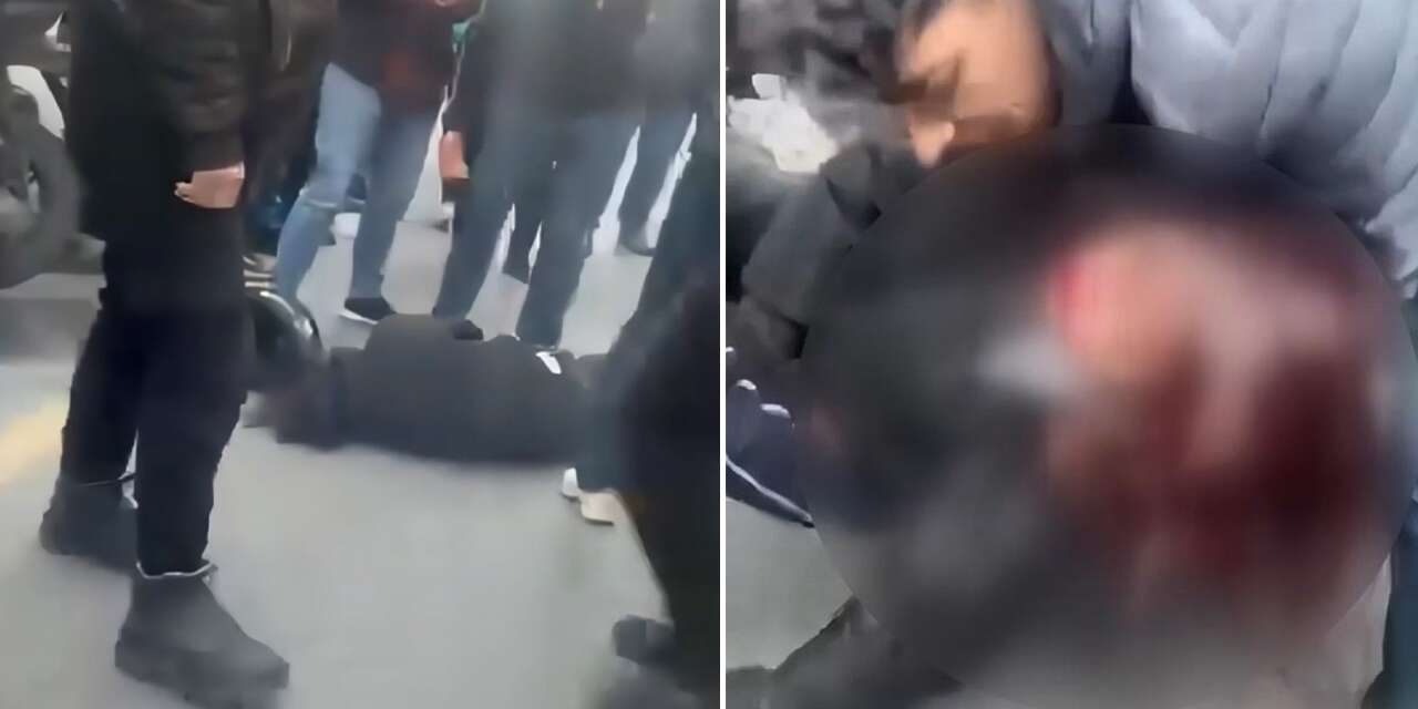 Kaza yapan ehliyetsiz sürücü yaralı kız arkadaşını bırakıp kaçtı