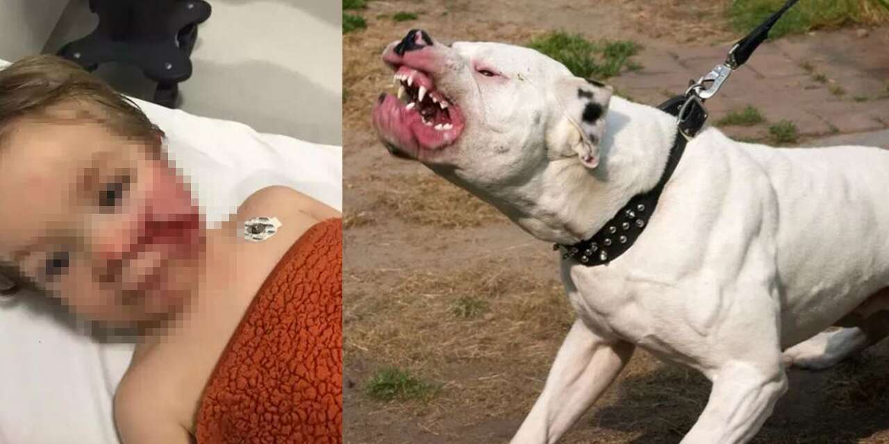 Pitbull cinsi köpek 1.5 ve 5 yaşındaki kardeşlere saldırmıştı! Sanık yargılanmaya başladı