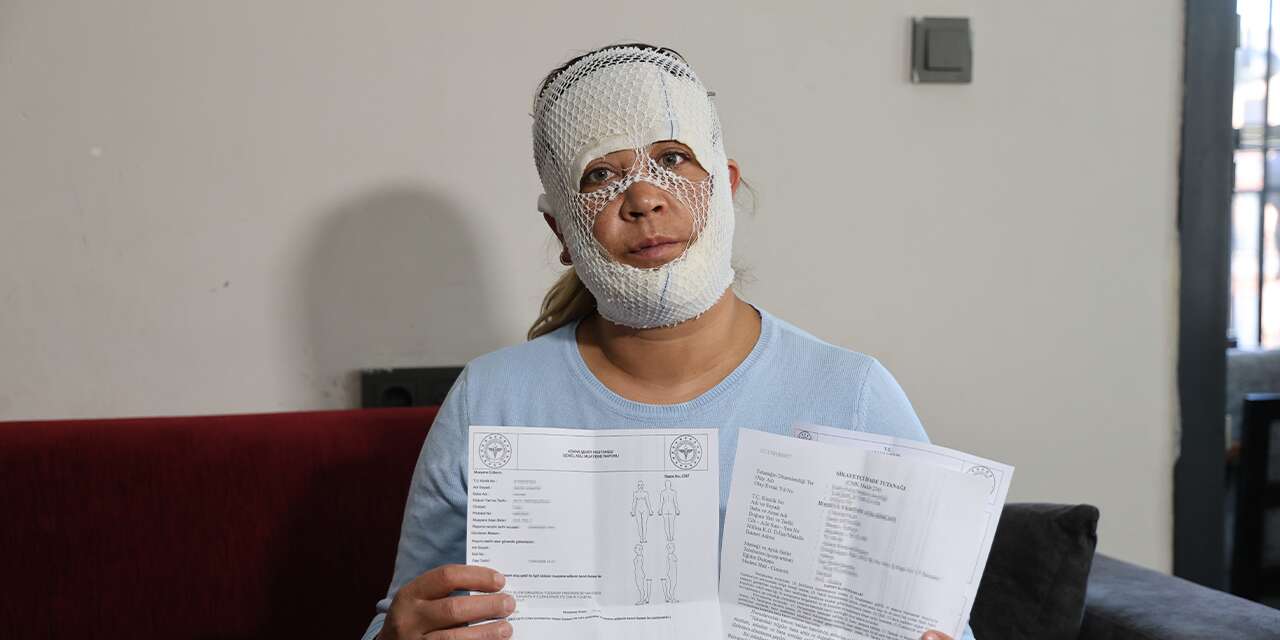 Gittiği güzellik merkezinde yüzü yandı