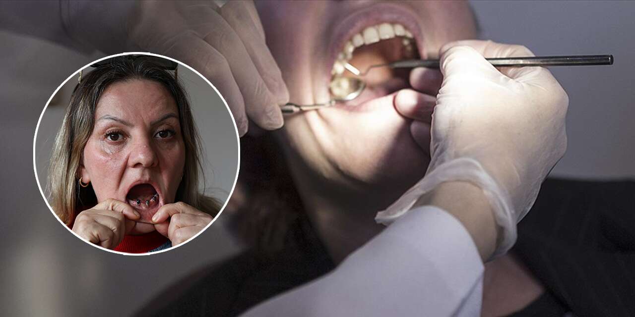 Diş ağrısıyla hastaneye gitti, hayatı kabusa döndü! 25 dişi birden çekildi