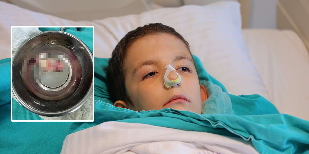 Burun tıkanıklığı şikayetiyle hastaneye gitti, gerçek bambaşka çıktı