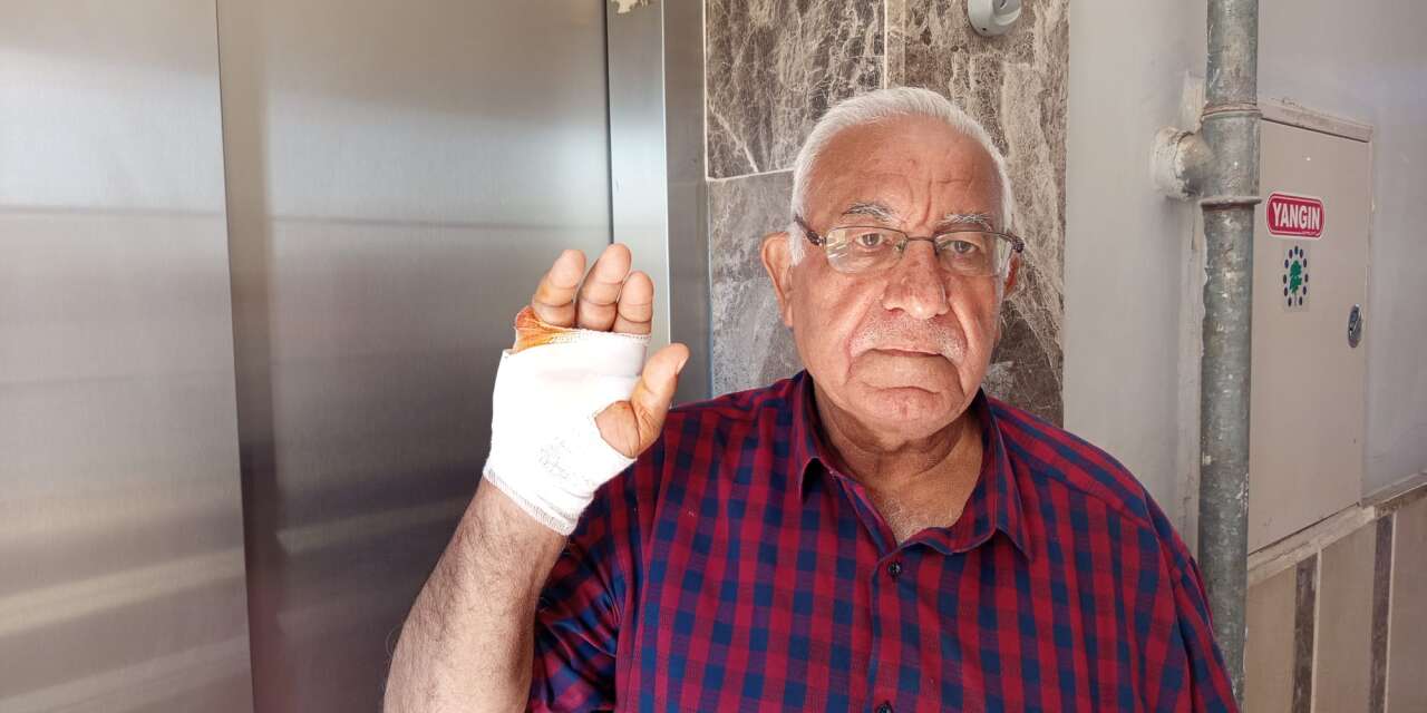 Asansörde komşu dehşeti! Parmağını ısırarak kopardı