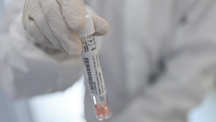 Oxford Üniversitesi: Koronavirüs aşısı eylülde hazır olabilir