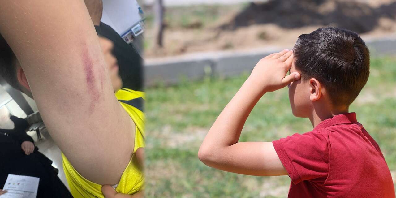 Konya’da ilkokul öğrencisi tartıştığı çocuğun annesi tarafından darbedildi