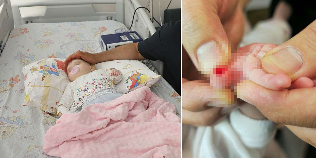 Hemşire, sargıyı çıkarırken 5 aylık bebeğin parmağını kesti! Aile şikayetçi