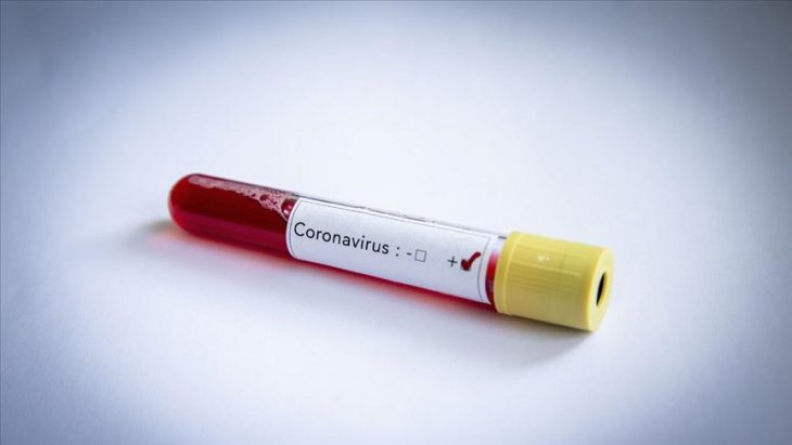Canına kıyan kişide koronavirüse rastlanınca yaklaşık 50 kişi karantinaya alındı