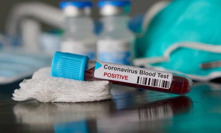 TBMM'de koronavirüs testi yapıldı
