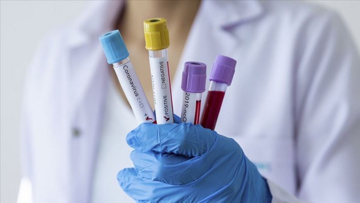 Dünya genelinde Kovid-19 bulaşan kişi sayısı 2 milyon 184 bini geçti