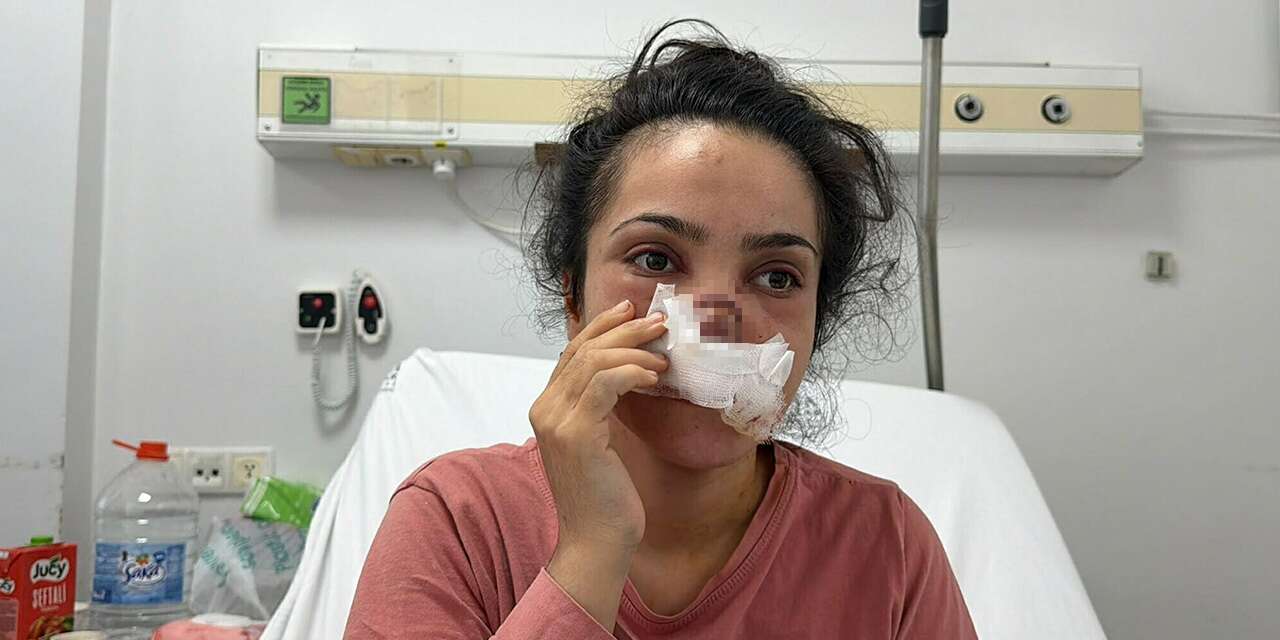 Eşi burnunu ısırıp koparmıştı! Genç kadın o gece yaşananları anlattı