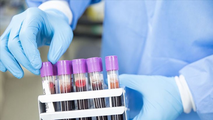 Dünya genelinde Kovid-19 bulaşan kişi sayısı 2 milyon 340 bini aştı