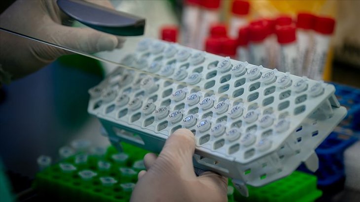 İstanbul'da bir hastadan alınan Kovid-19 virüsünün genomu dizilendi