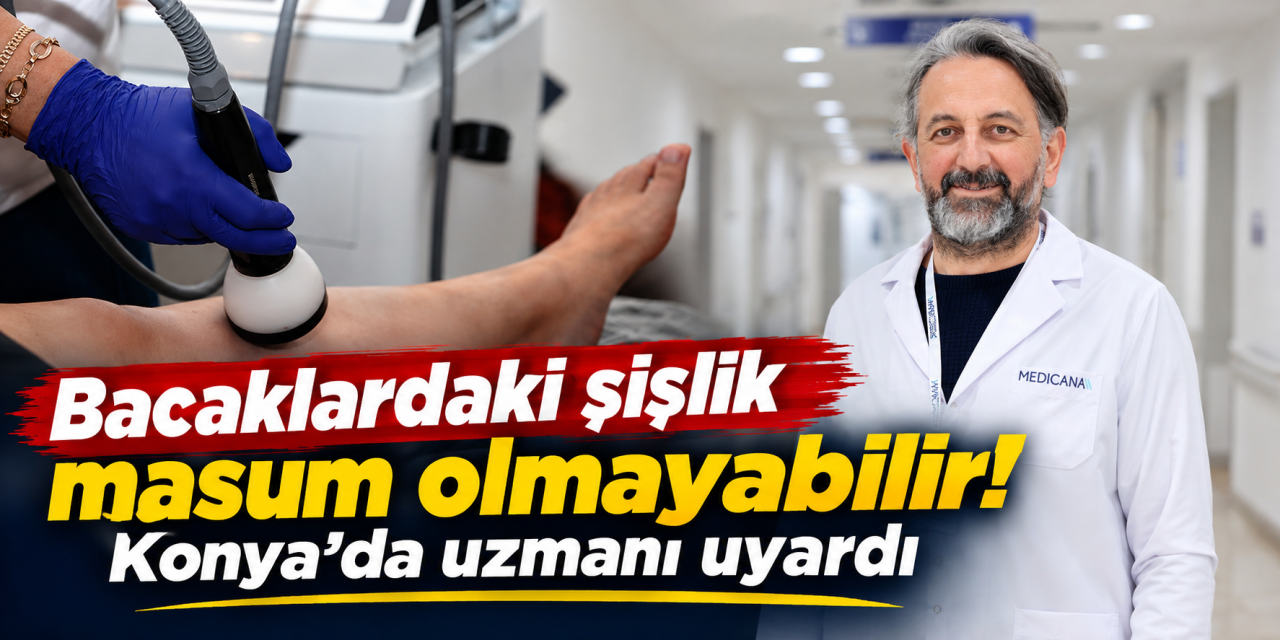 Konya’da uzman doktor uyardı! Ödem sandığınız şey başka bir hastalık olabilir