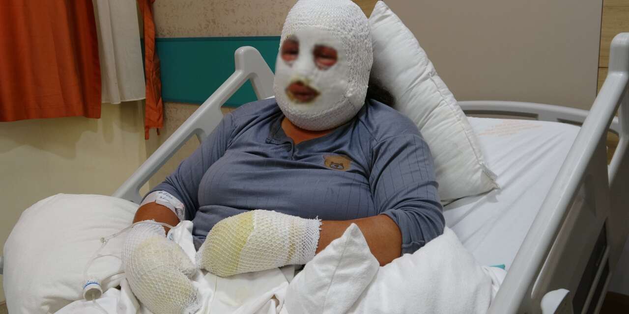Anne 6 yaşındaki evladı için alevlerin arasına daldı