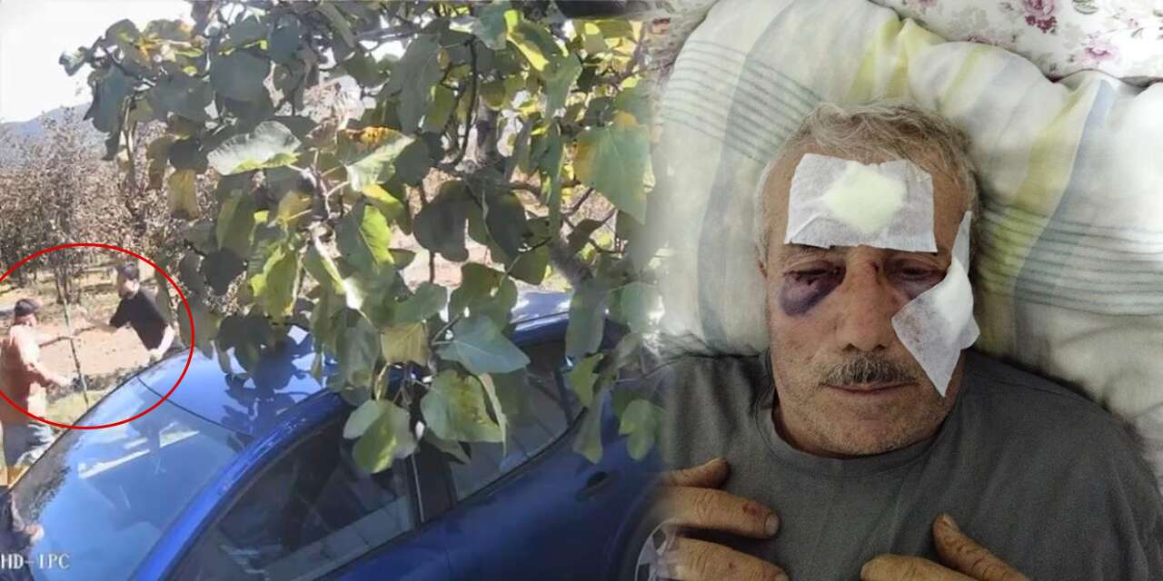 Öğretmen, yaşlı adamı muştayla darp etti! Sebebi de olay kadar vahim