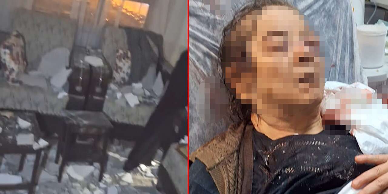 Evinde otururken dehşeti yaşadı! Görme kaybı ve burnunda kırık var