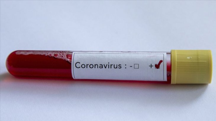 Süper Lig kulübündeki bir futbolcuda koronavirüs tespit edildi
