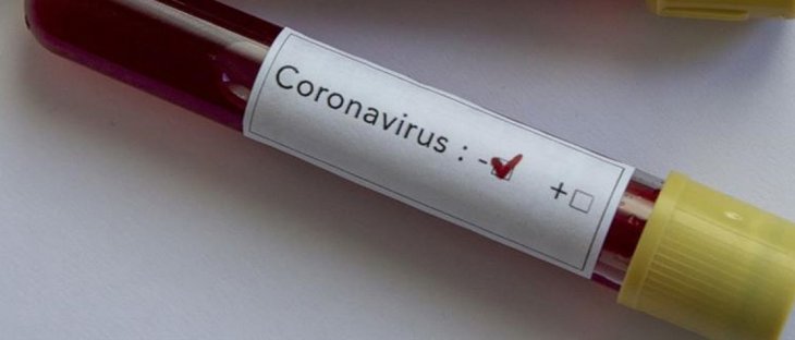 Bir ilimiz için daha koronavirüs müjdesi