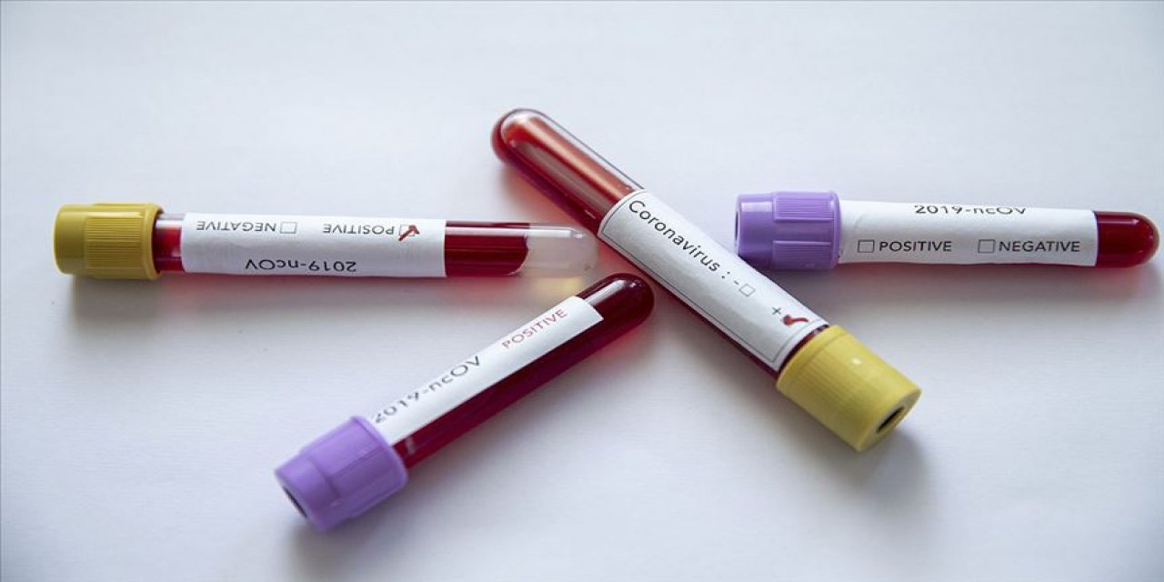 Akhisarspor'da Kovid-19 testi pozitif çıkan futbolcu sayısı 5'e yükseldi