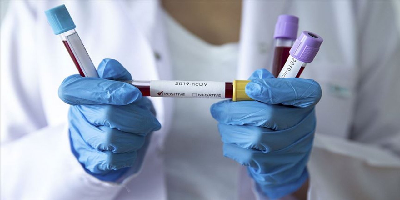 Korkutan tablo! "Aktif vaka sayısı bir ayda yüzde 50'den fazla arttı, hastaların virüs yükleri artık çok fazla"