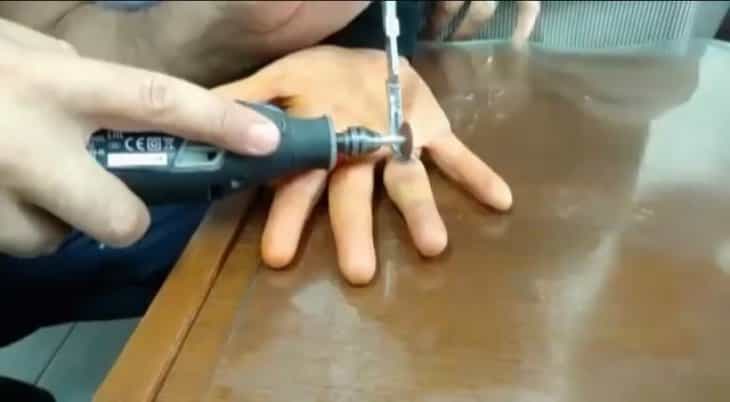 Sıkışan yüzüğü AFAD ekipleri çıkarttı