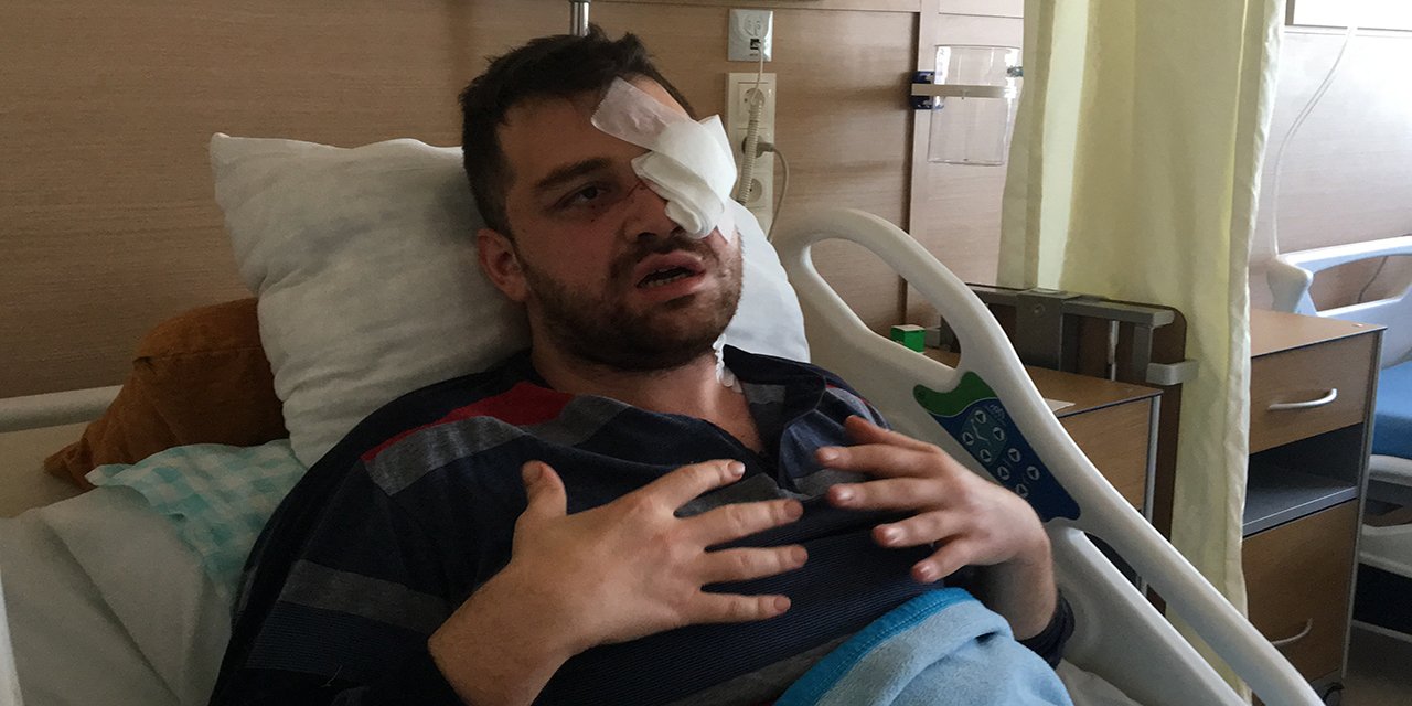 Konya’da avukatın sol gözünü kör eden saldırgan peruk takmış!