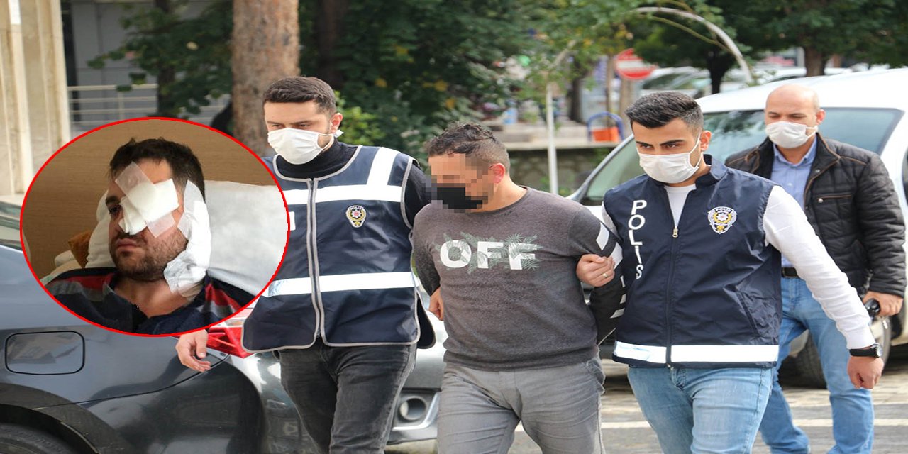Konya’da genç avukata bıçakla saldırıp kör eden peruklu saldırgan tanıdık çıktı!