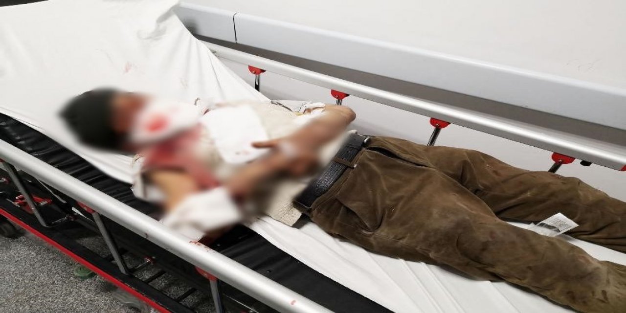 Misafirliğe gittiği evde dehşeti yaşadı! Köpek saldırısında ağır yaralanan yaşlı adam Konya'da tedavi altında