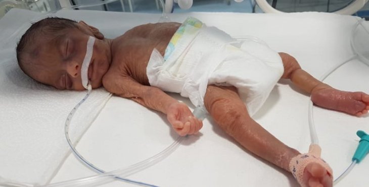 Konya’da anne karnındaki bebeğe başarılı ameliyat! Bebeğin ayaksız doğmasının önüne geçildi
