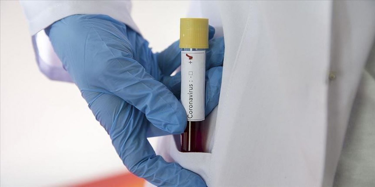 Kovid-19 hastalarının tedavi edildiği hastanede çıkan yangında 7 kişi öldü