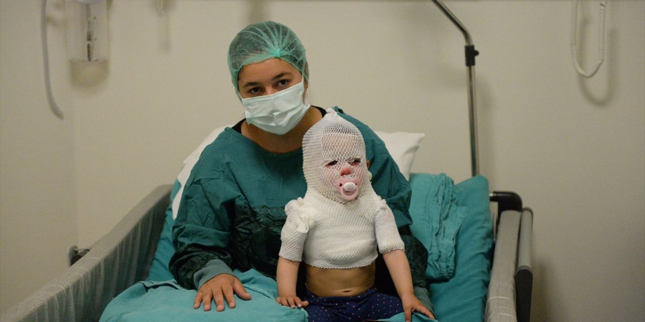 Üzerine sıcak su dökülen bebeğin tedavisi sürüyor