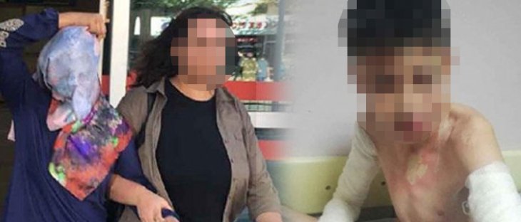 Konya'da komşuların üzerine kezzap döken kadın, zihinsel engelli çocuğu darbetmiş!