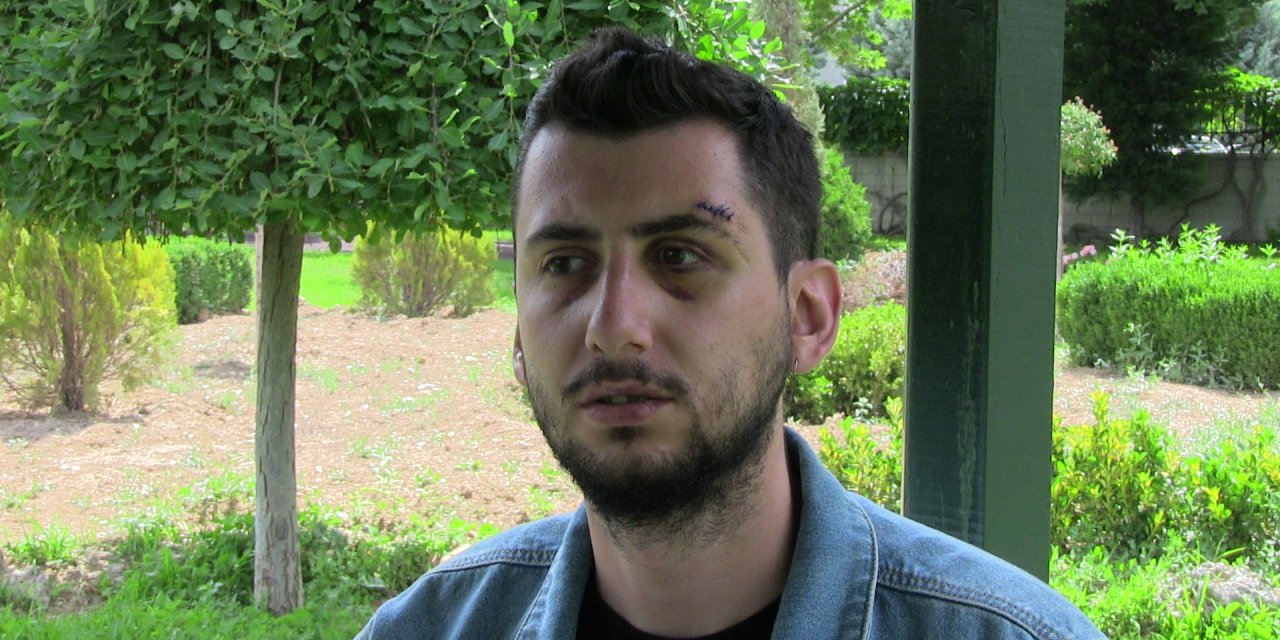 Konya’da özel güvenlikçi dehşeti! Eski kız arkadaşının evini basıp, muşta ile dövdü