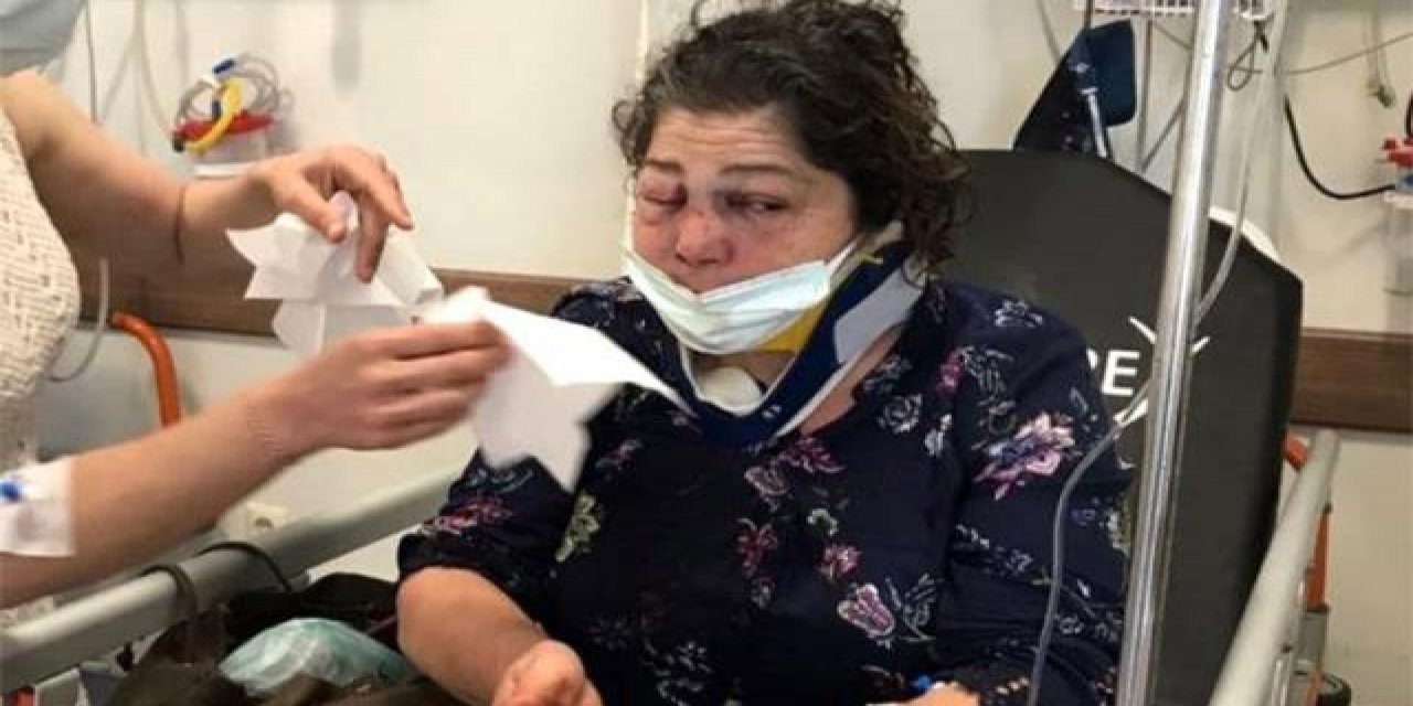 'Park bakımsız' diyen kadını CHP'li Başkanın adamları dövdü